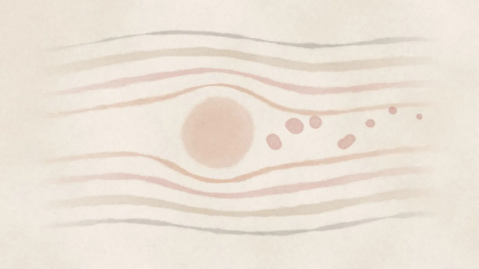 Staying Neutral: Why I Let Your Body Lead in CranioSacral Therapy